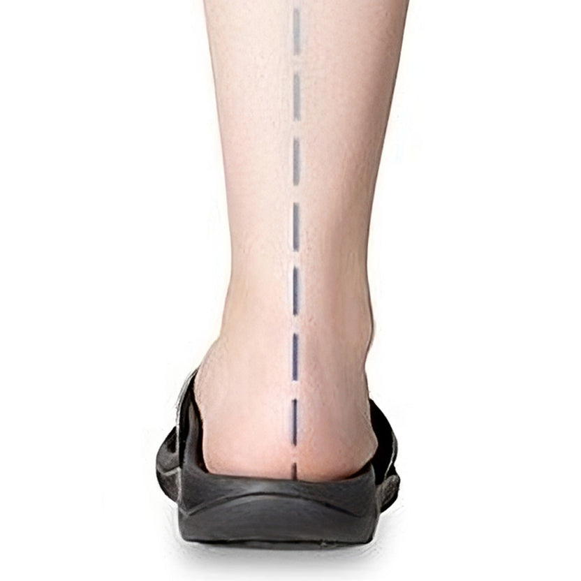 After_6702ffff-8d00-4121-87c5-7cbc5f468812.jpg (832×832)